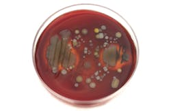 3602-waterborne-disease-prevention.jpg 3602-waterborne-disease-prevention.jpg