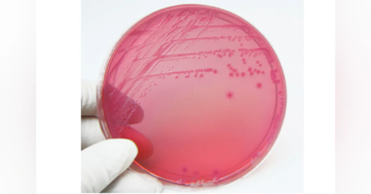 Coliform Container Contaminant of the Month: Coliform Bacteria | Water Tech Online