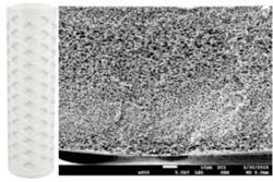 Figure5 300x200 Figure5 300x200