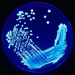 Legionella Plate 01 5ed8100e9c81e Legionella Plate 01 5ed8100e9c81e