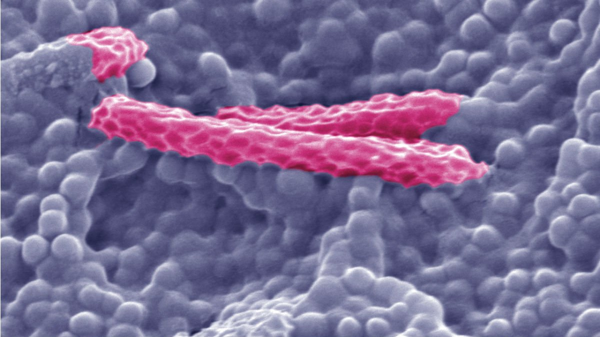Bacteria Surrey Main 5 Trehalose 5kv 25000 0501 5f4ff87195f72 5f5779faa6e73
