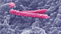 Bacteria Surrey Main 5 Trehalose 5kv 25000 0501 5f4ff87195f72